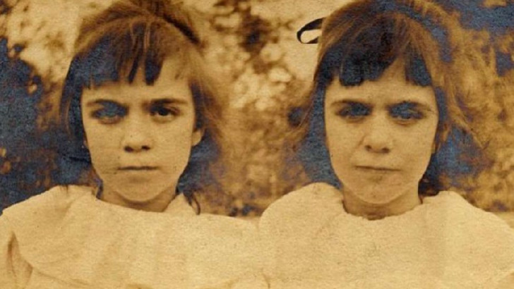 Okuduktan Sonra Reenkarnasyonu Sorgulamamanın İmkansız Olacağı Esrarengiz Olay: Pollock İkizleri
