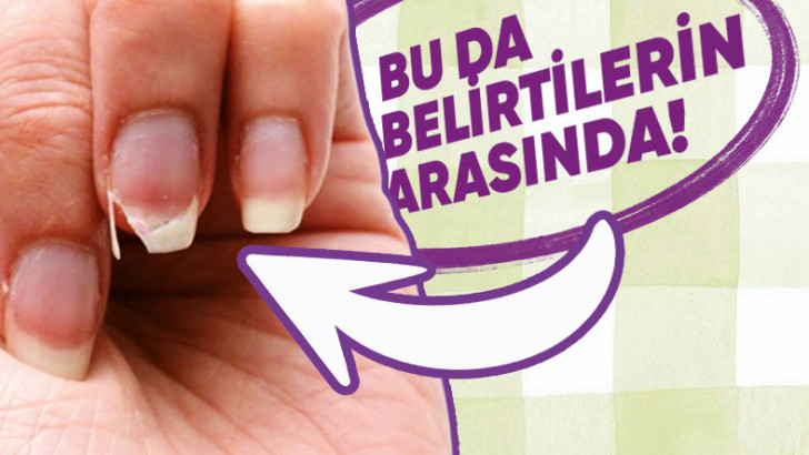 Pek Çok Hastalığın Temel Nedeni Olan 'Demir Eksikliğine' Ne İyi Gelir, Belirtileri Nelerdir?