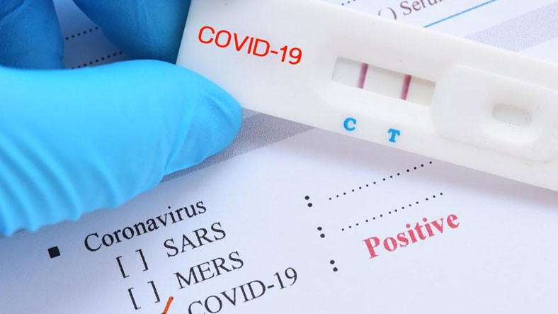 Koronvirüs Testi Negatif Çıkanlar İçin Kritik Uyarı: Yine de COVID-19 Hastasıymış Gibi Davranın