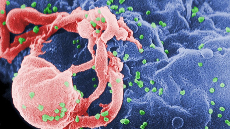 AIDS’e Neden Olan HIV Virüsünün Çok Daha Bulaşıcı ve Ölümcül Bir Varyantı Keşfedildi: Hem de 10 Yıllardır Aramızda