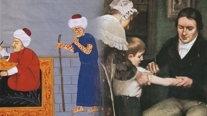 Osmanlıda Uygulanan Çiçek Hastalığı Tedavisi Nasıl Oldu da Tüm Avrupayı Kurtardı?