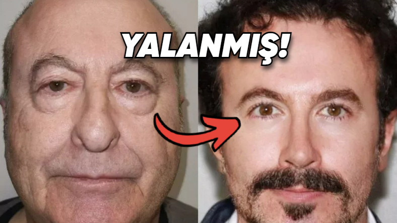 Türkiye’de Geçirdiği Operasyonla Yüzü Değişen Adamın Görüntüleri Sahteymiş