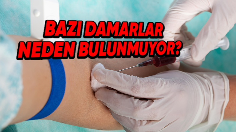 Damarlar, Kan Verme Sırasında Neden Zor Bulunur?