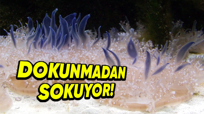 Denizanaları Vücuda Dokunmadan Nasıl Sokabilir?