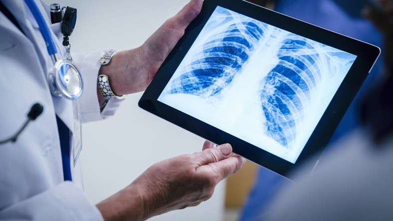 Google'dan Akciğer Rahatsızlıklarını Tespit Eden Yapay Zeka